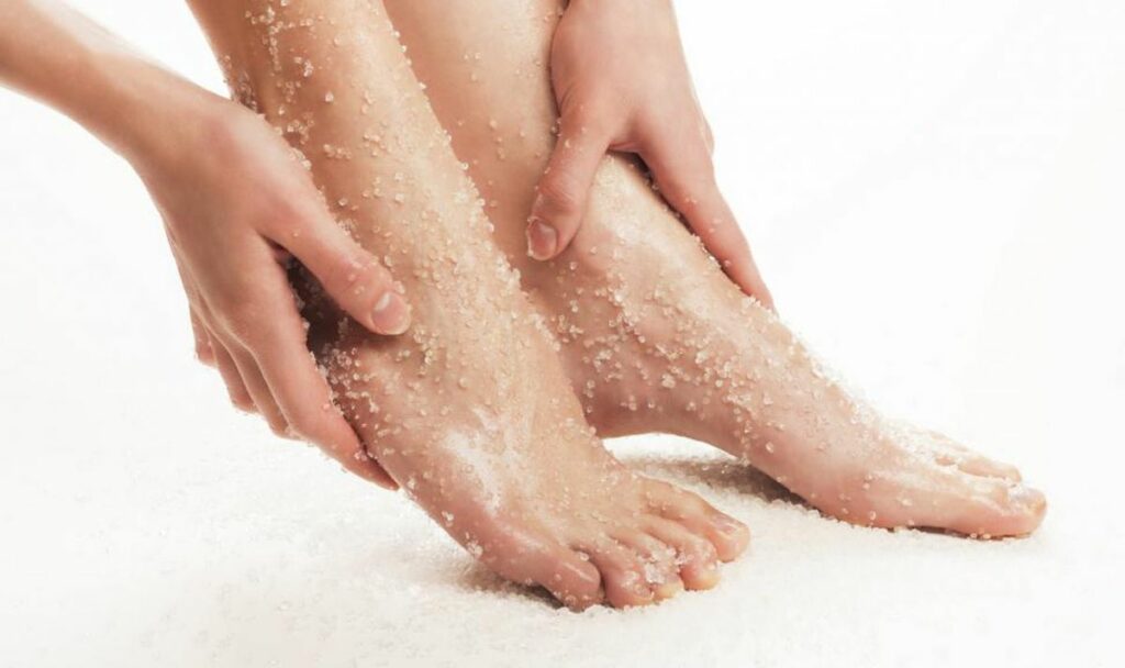 peeling pied